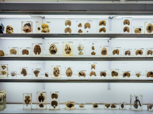 NIMHANS Brain Museum, Bengaluru