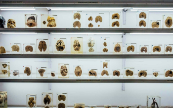 NIMHANS Brain Museum, Bengaluru