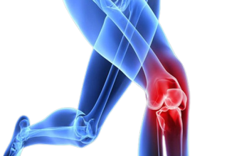Zoi Hospitals, Best Orthopedic Hospital in Hyderabad